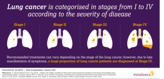 这张动画图解释了两种主要肺癌形式之间的差异，以及两种主要肺癌形式是如何分级的。